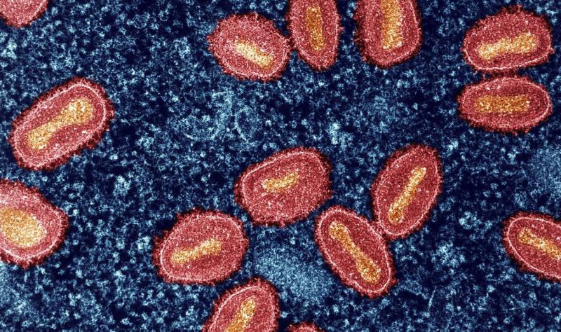 New mpox clade 1 lineage identified in DR Congo outbreak | CIDRAP